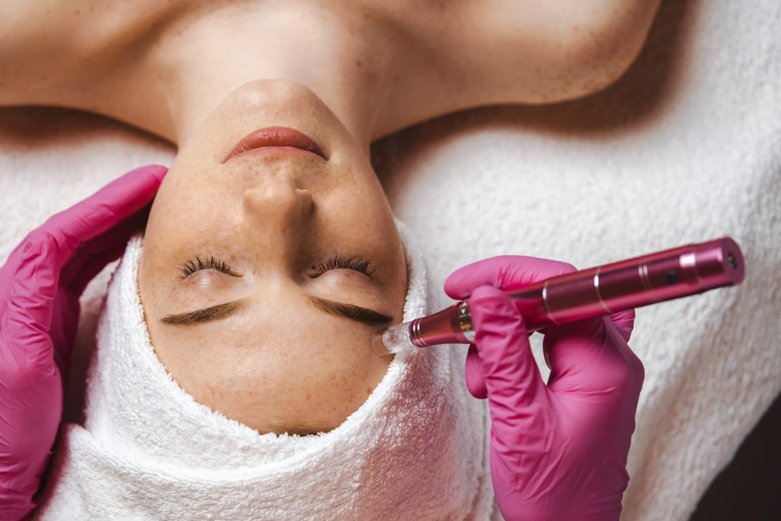 Patient getting facial fillers