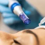 Skin rejuvenation treatment at Greenwich Medical Spa for natural-looking skin improvement without filler.